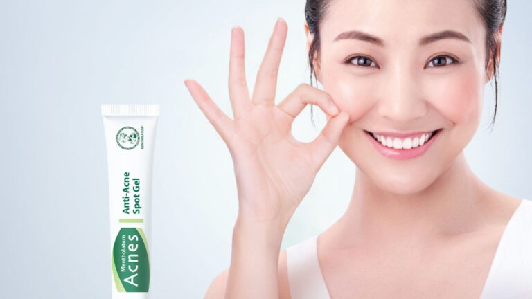 Fight breakouts like your ults with Acnes’ Anti-Acne Spot Gel and more