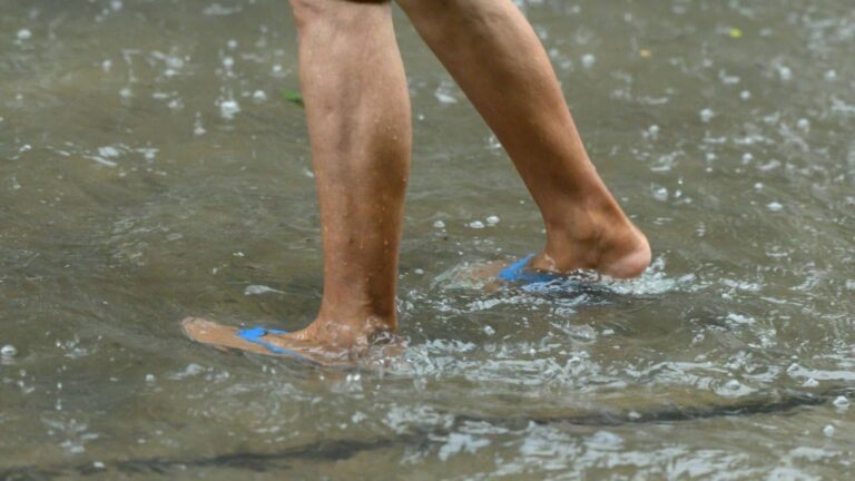 Everybody can get leptospirosis – here’s how to avoid it